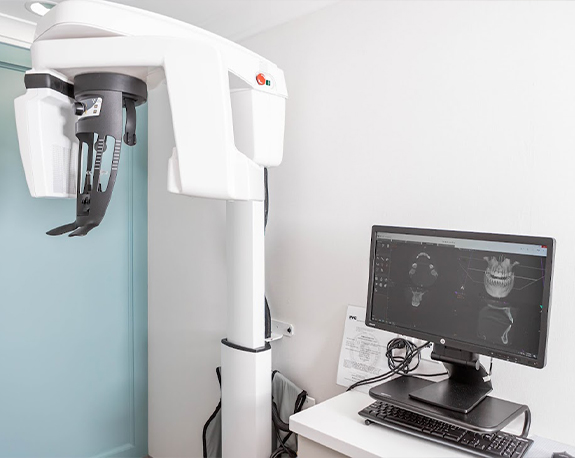 C T cone beam scanner next to computer screen showing 3 D model of teeth and jaws