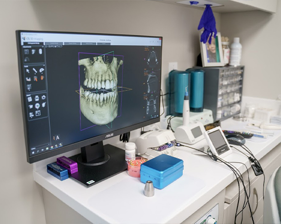 Computer screen showing 3 D models of a patient's jaws and teeth