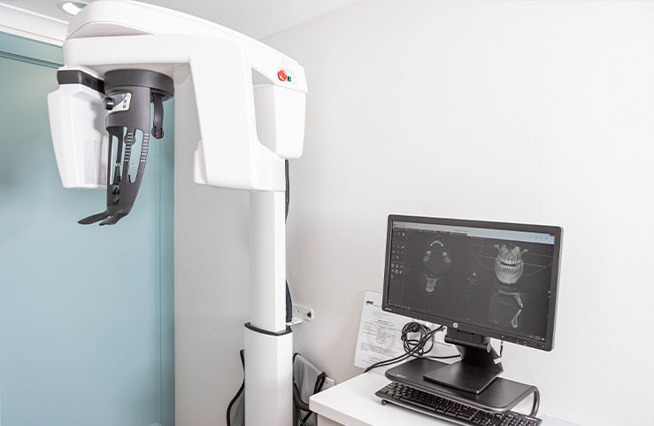 Dental scanner next to computer screen showing 3 D models of teeth and jaw