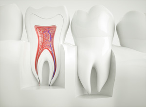 3D diagram of a root canal